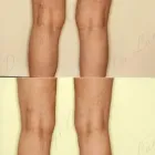 251 üzleti kép ZSÍRLESZÍVÁS KLINIKA DR LÁNYI CECÍLIA Plasztikai sebészet ban/ben Budapest