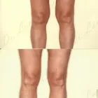 252 üzleti kép ZSÍRLESZÍVÁS KLINIKA DR LÁNYI CECÍLIA Plasztikai sebészet ban/ben Budapest