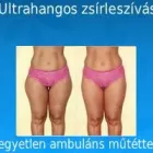 255 üzleti kép ZSÍRLESZÍVÁS KLINIKA DR LÁNYI CECÍLIA Plasztikai sebészet ban/ben Budapest