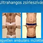 257 üzleti kép ZSÍRLESZÍVÁS KLINIKA DR LÁNYI CECÍLIA Plasztikai sebészet ban/ben Budapest