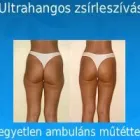 259 üzleti kép ZSÍRLESZÍVÁS KLINIKA DR LÁNYI CECÍLIA Plasztikai sebészet ban/ben Budapest