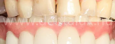 1 üzleti kép DENT-A-LUX FOGÁSZAT KECSKEMÉT, DR. KŐHALMI TAMÁS FOGORVOS - WWW.DENTALUX.HU Fogászat, fogszabályzás ban/ben Kecskemét BK