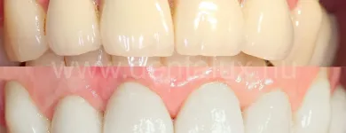 2 üzleti kép DENT-A-LUX FOGÁSZAT KECSKEMÉT, DR. KŐHALMI TAMÁS FOGORVOS - WWW.DENTALUX.HU Fogászat, fogszabályzás ban/ben Kecskemét BK