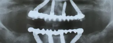 1 üzleti kép DR. TERBÓCZ KATALIN FOGORVOS Sebészet ban/ben Budapest