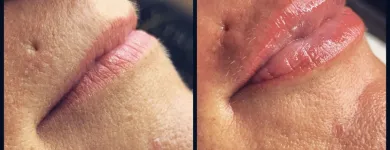 13 üzleti kép PILLABÁZIS Szépségszalon, kozmetika ban/ben Székesfehérvár FE