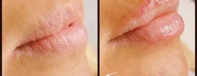 14 üzleti kép PILLABÁZIS Szépségszalon, kozmetika ban/ben Székesfehérvár FE