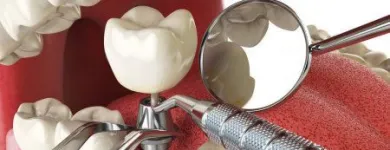 4 üzleti kép RÉPAY-DENT KFT. - FOGTECHNIKA Fogtechnika ban/ben Kaposvár SO
