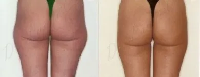 1 üzleti kép ZSÍRLESZÍVÁS KLINIKA DR LÁNYI CECÍLIA Plasztikai sebészet ban/ben Budapest