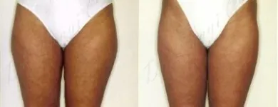 7 üzleti kép ZSÍRLESZÍVÁS KLINIKA DR LÁNYI CECÍLIA Plasztikai sebészet ban/ben Budapest