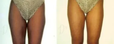 8 üzleti kép ZSÍRLESZÍVÁS KLINIKA DR LÁNYI CECÍLIA Plasztikai sebészet ban/ben Budapest