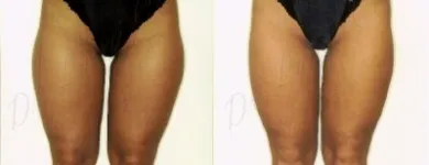 9 üzleti kép ZSÍRLESZÍVÁS KLINIKA DR LÁNYI CECÍLIA Plasztikai sebészet ban/ben Budapest