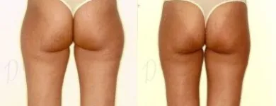 13 üzleti kép ZSÍRLESZÍVÁS KLINIKA DR LÁNYI CECÍLIA Plasztikai sebészet ban/ben Budapest