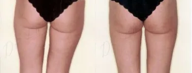 14 üzleti kép ZSÍRLESZÍVÁS KLINIKA DR LÁNYI CECÍLIA Plasztikai sebészet ban/ben Budapest