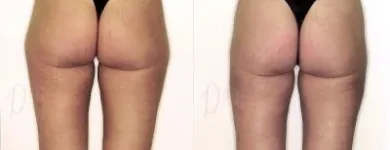 15 üzleti kép ZSÍRLESZÍVÁS KLINIKA DR LÁNYI CECÍLIA Plasztikai sebészet ban/ben Budapest