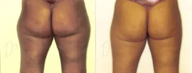 16 üzleti kép ZSÍRLESZÍVÁS KLINIKA DR LÁNYI CECÍLIA Plasztikai sebészet ban/ben Budapest