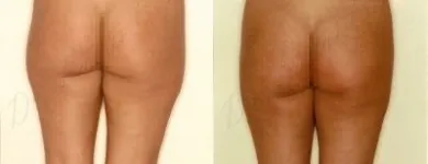 17 üzleti kép ZSÍRLESZÍVÁS KLINIKA DR LÁNYI CECÍLIA Plasztikai sebészet ban/ben Budapest