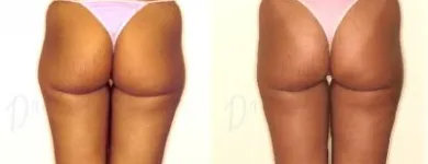 18 üzleti kép ZSÍRLESZÍVÁS KLINIKA DR LÁNYI CECÍLIA Plasztikai sebészet ban/ben Budapest