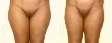 19 üzleti kép ZSÍRLESZÍVÁS KLINIKA DR LÁNYI CECÍLIA Plasztikai sebészet ban/ben Budapest