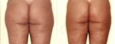 21 üzleti kép ZSÍRLESZÍVÁS KLINIKA DR LÁNYI CECÍLIA Plasztikai sebészet ban/ben Budapest