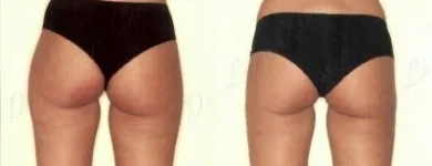 22 üzleti kép ZSÍRLESZÍVÁS KLINIKA DR LÁNYI CECÍLIA Plasztikai sebészet ban/ben Budapest