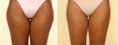 24 üzleti kép ZSÍRLESZÍVÁS KLINIKA DR LÁNYI CECÍLIA Plasztikai sebészet ban/ben Budapest