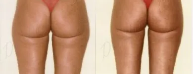 26 üzleti kép ZSÍRLESZÍVÁS KLINIKA DR LÁNYI CECÍLIA Plasztikai sebészet ban/ben Budapest