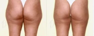 28 üzleti kép ZSÍRLESZÍVÁS KLINIKA DR LÁNYI CECÍLIA Plasztikai sebészet ban/ben Budapest