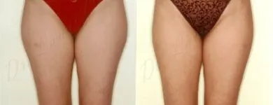 29 üzleti kép ZSÍRLESZÍVÁS KLINIKA DR LÁNYI CECÍLIA Plasztikai sebészet ban/ben Budapest