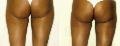 31 üzleti kép ZSÍRLESZÍVÁS KLINIKA DR LÁNYI CECÍLIA Plasztikai sebészet ban/ben Budapest