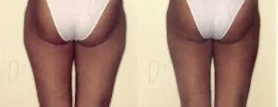 33 üzleti kép ZSÍRLESZÍVÁS KLINIKA DR LÁNYI CECÍLIA Plasztikai sebészet ban/ben Budapest