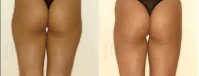 36 üzleti kép ZSÍRLESZÍVÁS KLINIKA DR LÁNYI CECÍLIA Plasztikai sebészet ban/ben Budapest