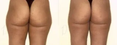 39 üzleti kép ZSÍRLESZÍVÁS KLINIKA DR LÁNYI CECÍLIA Plasztikai sebészet ban/ben Budapest