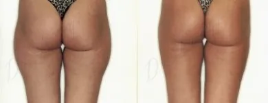 43 üzleti kép ZSÍRLESZÍVÁS KLINIKA DR LÁNYI CECÍLIA Plasztikai sebészet ban/ben Budapest