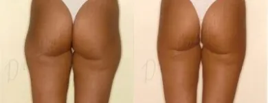 44 üzleti kép ZSÍRLESZÍVÁS KLINIKA DR LÁNYI CECÍLIA Plasztikai sebészet ban/ben Budapest