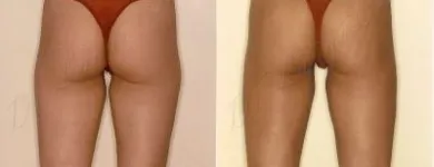 46 üzleti kép ZSÍRLESZÍVÁS KLINIKA DR LÁNYI CECÍLIA Plasztikai sebészet ban/ben Budapest