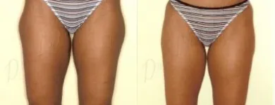 49 üzleti kép ZSÍRLESZÍVÁS KLINIKA DR LÁNYI CECÍLIA Plasztikai sebészet ban/ben Budapest