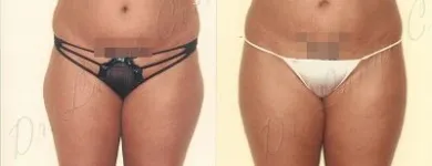 52 üzleti kép ZSÍRLESZÍVÁS KLINIKA DR LÁNYI CECÍLIA Plasztikai sebészet ban/ben Budapest