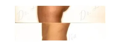 53 üzleti kép ZSÍRLESZÍVÁS KLINIKA DR LÁNYI CECÍLIA Plasztikai sebészet ban/ben Budapest