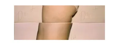 54 üzleti kép ZSÍRLESZÍVÁS KLINIKA DR LÁNYI CECÍLIA Plasztikai sebészet ban/ben Budapest