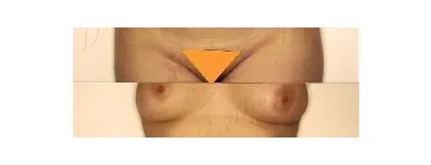 57 üzleti kép ZSÍRLESZÍVÁS KLINIKA DR LÁNYI CECÍLIA Plasztikai sebészet ban/ben Budapest