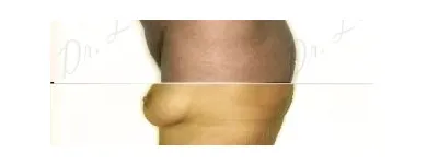 60 üzleti kép ZSÍRLESZÍVÁS KLINIKA DR LÁNYI CECÍLIA Plasztikai sebészet ban/ben Budapest