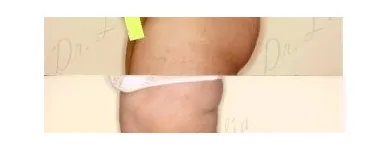 64 üzleti kép ZSÍRLESZÍVÁS KLINIKA DR LÁNYI CECÍLIA Plasztikai sebészet ban/ben Budapest