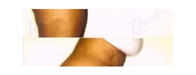 65 üzleti kép ZSÍRLESZÍVÁS KLINIKA DR LÁNYI CECÍLIA Plasztikai sebészet ban/ben Budapest