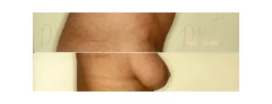 66 üzleti kép ZSÍRLESZÍVÁS KLINIKA DR LÁNYI CECÍLIA Plasztikai sebészet ban/ben Budapest