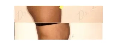 68 üzleti kép ZSÍRLESZÍVÁS KLINIKA DR LÁNYI CECÍLIA Plasztikai sebészet ban/ben Budapest