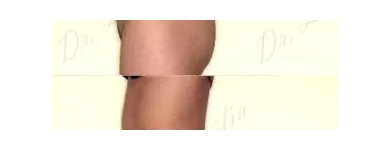 71 üzleti kép ZSÍRLESZÍVÁS KLINIKA DR LÁNYI CECÍLIA Plasztikai sebészet ban/ben Budapest