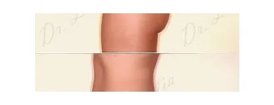 72 üzleti kép ZSÍRLESZÍVÁS KLINIKA DR LÁNYI CECÍLIA Plasztikai sebészet ban/ben Budapest