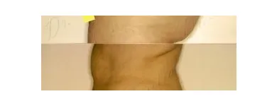 73 üzleti kép ZSÍRLESZÍVÁS KLINIKA DR LÁNYI CECÍLIA Plasztikai sebészet ban/ben Budapest