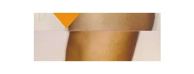 74 üzleti kép ZSÍRLESZÍVÁS KLINIKA DR LÁNYI CECÍLIA Plasztikai sebészet ban/ben Budapest