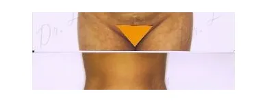 75 üzleti kép ZSÍRLESZÍVÁS KLINIKA DR LÁNYI CECÍLIA Plasztikai sebészet ban/ben Budapest